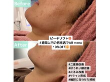 エン クリニカルラボ(E&N CLINICAL LABO)の雰囲気(韓国人のようなVライン輪郭作り☆たるみ/リフティング/引き上げ)