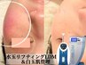 【赤み/紫外線/花粉黄砂/乾燥】水玉リフティング&白玉肌管理 44,000→38,900