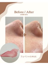 エルアンドエル(L&L)/フェイシャルワックス