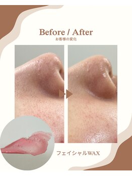 エルアンドエル(L&L)/フェイシャルワックス