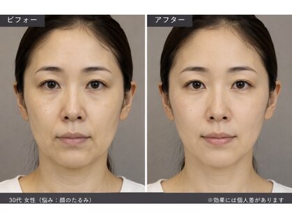 ピーチ ローズ(peach rose)の写真