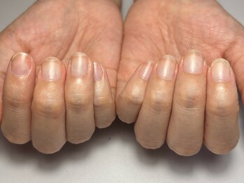 ナル(Nalu.)の写真/爪を見られるのが恥ずかしい方に。自爪育成で綺麗を叶えるネイルサロンへ行ってみませんか♪