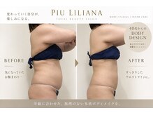 ピュウリリアーナ(Piu liliana)の雰囲気（より良い施術をご提供できる様、研修を重ね技術を磨いています。）
