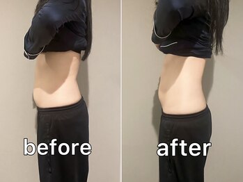 サンク(Cinq)/【腸もみ+骨盤矯正】内臓下垂