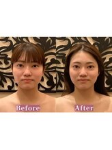 アジール 長岡リバーサイド千秋店(agir)/Before/After画像