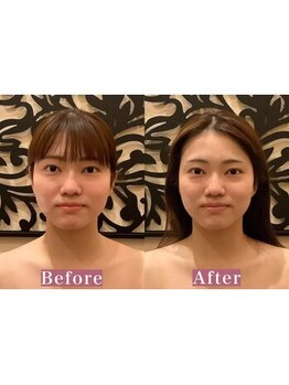 アジール 長岡リバーサイド千秋店(agir)/Before/After画像