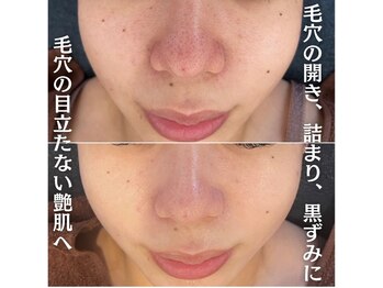 ファシル(Facile)/つるつる毛穴