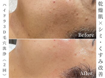 ゼアー(THERE FY.)/