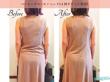 ホットストーン×アロマトリートメントの施術で筋肉を緩める。