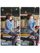 ピーチ(Peach)/筋膜リリース Before＆After