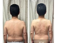 ウラヤス 恵比寿(Urayasu)の雰囲気(男性、筋膜リリース1回)