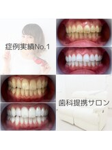 ホワイトニングサロン 名古屋駅店&nbsp;歯科提携 サロン