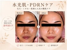 ルアナ 柏店(LUANA)の雰囲気（水光肌・PDRNケア毛穴・くすみ・乾燥に人気の艶肌ケア）