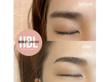 エヌプラス(N+)/ハリウッドブロウリフト(HBL)