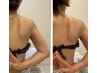 背面美人グイグイ痩身コース/上下カッサリンパ&ラジオ波スタイルUP8800→8500