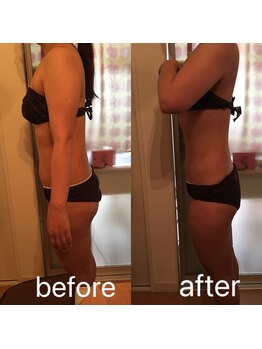 リンパケアサロン ジュビル(Jubil)/大人気のラジオ波&キャビで痩身