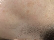 エミリー 守山(EMILY)