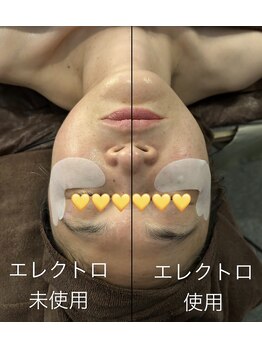 アヴァンサル 札幌駅前店(Avanzar)/完全都度払いフェイシャル