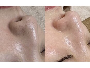 アネラ 南森町(ANERA)