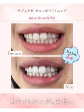 エクシアホワイトニング 浜松店/ホワイトニングビフォーアフター