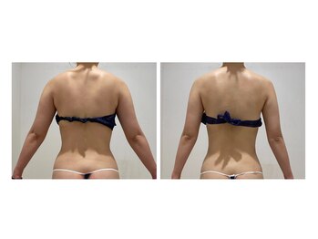 未来型スパエステ サリスパ(SARI SPA)/ビフォーアフター