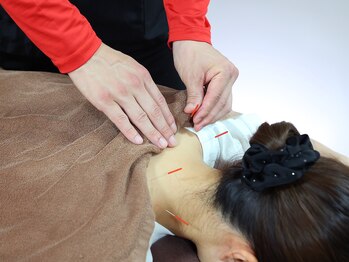 クレアーレはり きゅう整骨院 萱島店の写真/鍼灸施術を受けたい方必見！首肩こり、頭痛の改善！症状に応じてお悩みにアプローチ☆