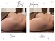 アッシュビー 伊勢崎(H.B.)の写真/伊勢崎でバスト悩みを解消◎垂れ・削げを最新マシン×筋膜リリースでふっくら美バストへ♪