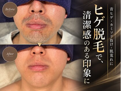 ボゴス 天白店(BOGOSS)の写真