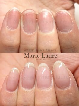 マリーロール 梅田店(Marie Laure)/深爪改善/自爪育成/ネイルケア