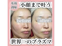 エミュローズ 段原店(Nm' Rose)/小顔まで叶う！