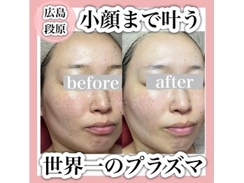 エミュローズ 段原店(Nm' Rose)/小顔まで叶う！
