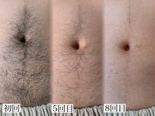 身体のbefore＆after☆清潔感アップ♪