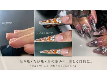 ルチドゥネイル(lucido.nail)の写真/反り爪・幅広爪も美しく見せるスカルプ技術