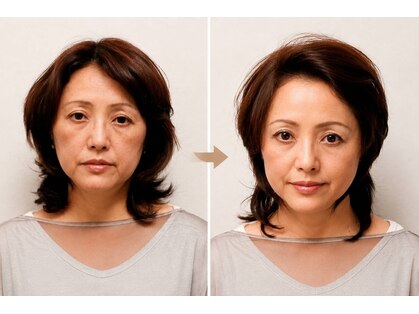 ピーチ ローズ(peach rose)の写真