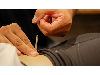 エルエスケー(LSK)/鍼施術