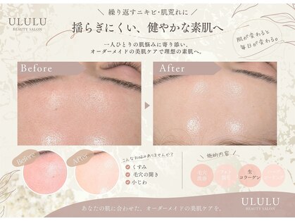 ウルル 栄店(ULULU)の写真