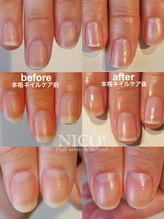 ニコプラス(NICO+)/ジェルネイルができない方向け