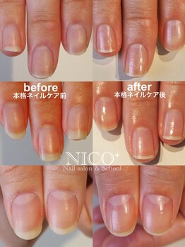 ニコプラス(NICO+)/ジェルネイルができない方向け