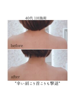 エミ(emi)/肩こり、首コリは小顔の大敵です