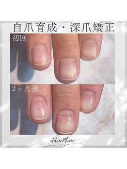 アトリエ ミュリー 代官山(atelier murir)/自爪育成・深爪矯正・巻き爪ケア