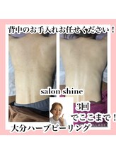 サロンシャイン(Salon Shine)/ハーブピーリング背中3回