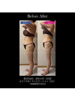 フェレザ 新潟(Felleza)/新潟-痩身エステ-BODYエステ