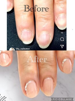 リリー(Lilly)/自爪育成ジェルネイル