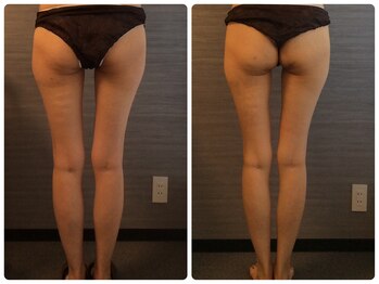 美容整体 ウェリナ 蟹江院/小顔矯正/骨盤矯正/美脚サロン