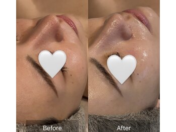 クレシア(CRECIA)/ララピール