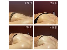 ネイト ワックス(Neit Wax)/バスト4回ビフォーアフター