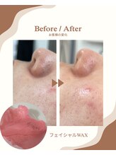 エルアンドエル(L&L)/フェイシャルワックス