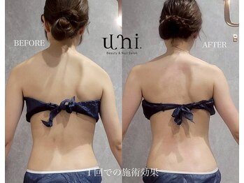 ユニ(uni.)/ブライダルの前に