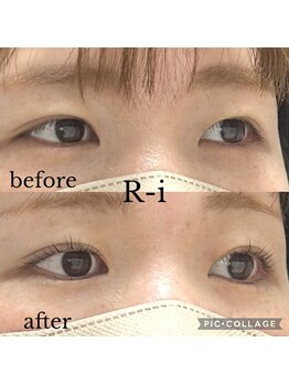 アールアイ(R-i)/アイリッドアップパーマ