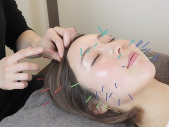 バスト鍼ラボ 代々木上原(BUST 鍼LAB.)の写真/【身体を整える美容鍼】フェイシャルラインからデコルテをすっきり!内側からのアプローチでふっくらバスト